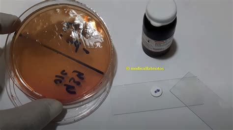 oxidase test for pseudomonas aeruginosa